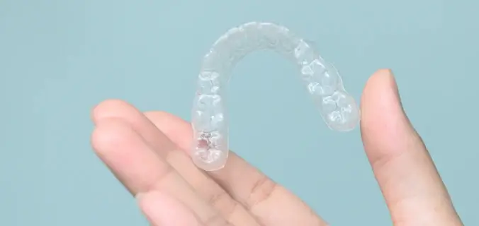 自分で取り外しできる