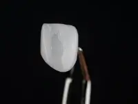 前歯の色や形が悪い